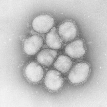 インフルエンザ ウィルスの弱点とは？！